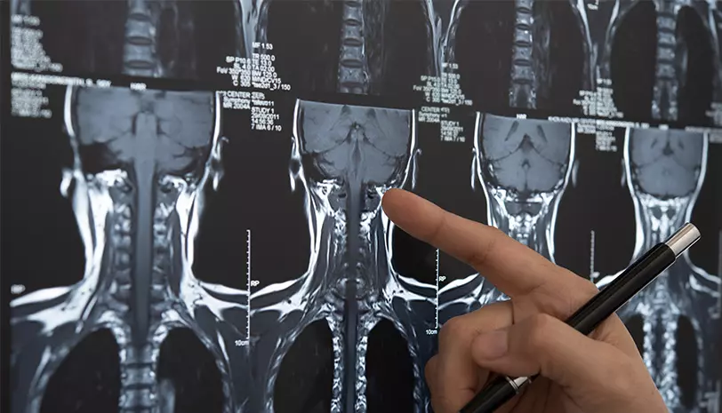 Procedimientos de Neuriología